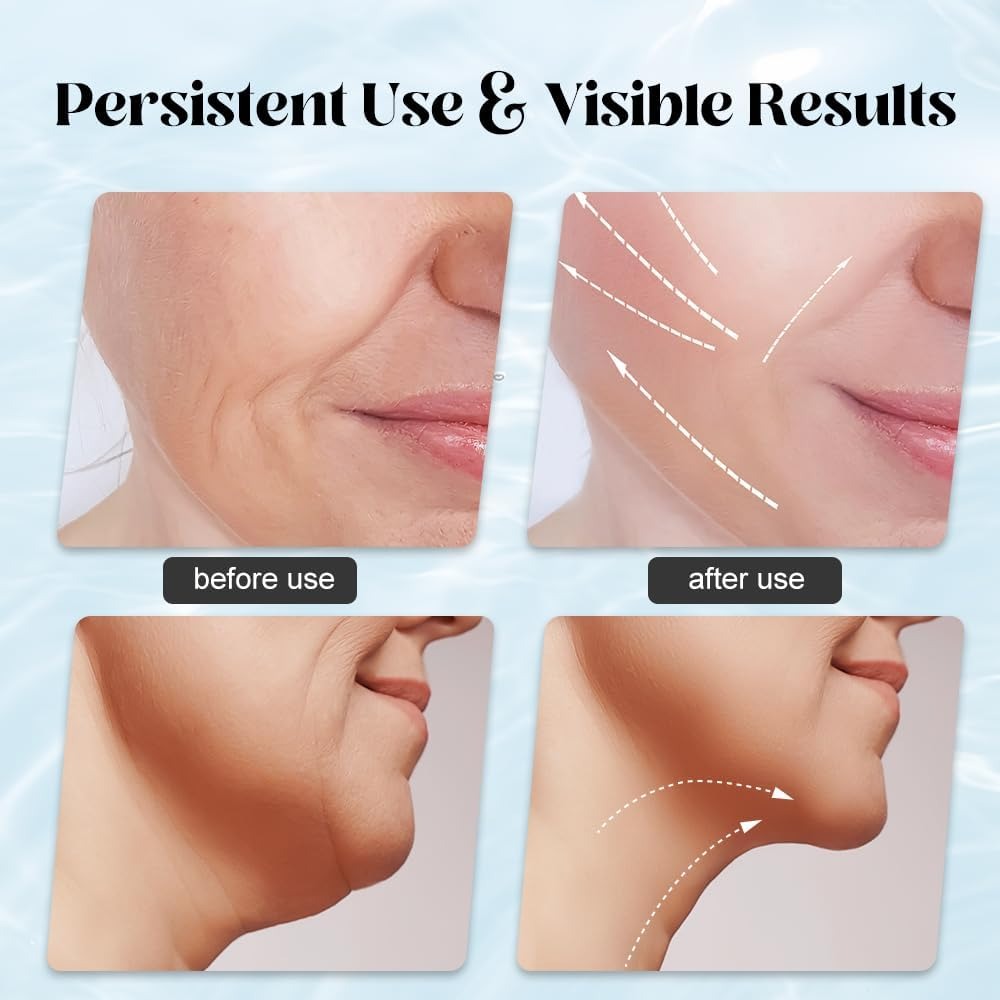 EMS Face Lifting Massager – Microcurrent Red Light Therapy Anti-Wrinkle Skin Care Device | Buy Online Pakistan